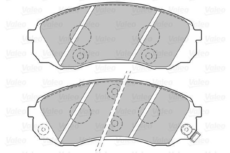 VALEO 301077 SBB-Satz FIRST