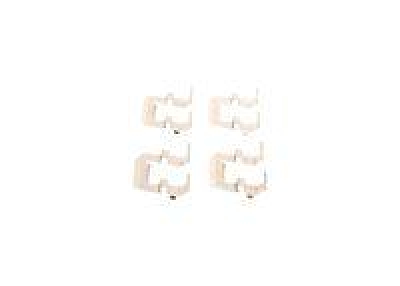 Bosch 1 987 474 480 Zubeh&ouml;rsatz AP535